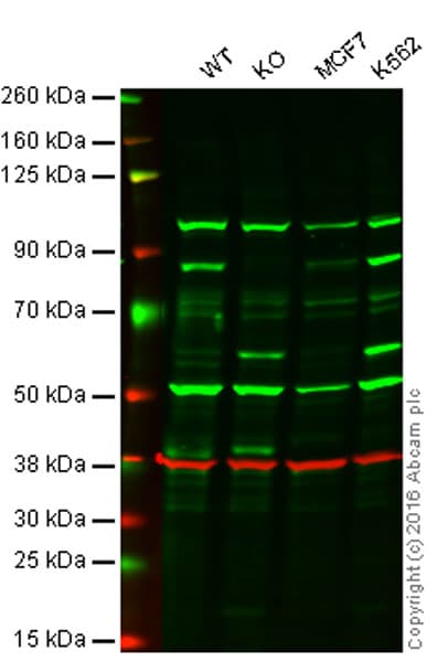 Anti-RSK1 p90 antibody [Y81](AB32526)