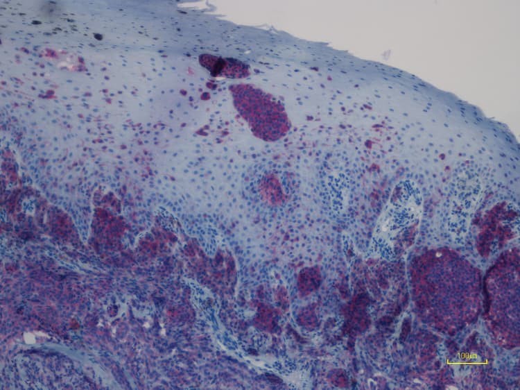 Anti-Ras (mutated Q61R) antibody [SP174](AB227658)