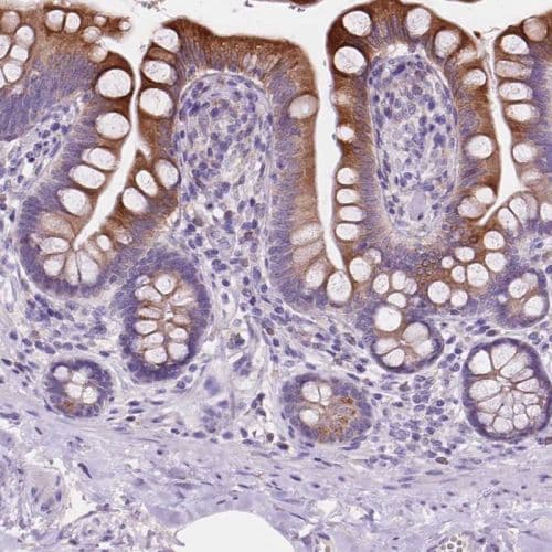 Ireb2 Irp2 Antibody Ab244539  Immunohistochemistry Formalin Pfa Fixed Paraffin Embedded Sections Img127517