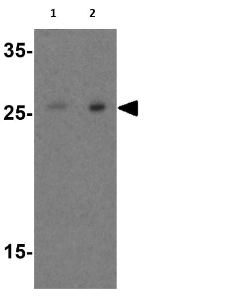Anti-RSPO1 antibody(AB106556)