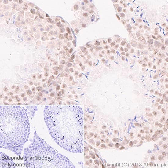 Rad50 Antibody Epr20968 Bsa And Azide Free Ab236460  Immunohistochemistry Formalin Pfa Fixed Paraffin Embedded Sections Img88178