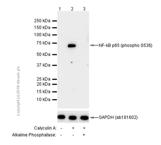 Anti-NF-kB p65 (phospho S536) antibody [EP2294Y](AB76302)