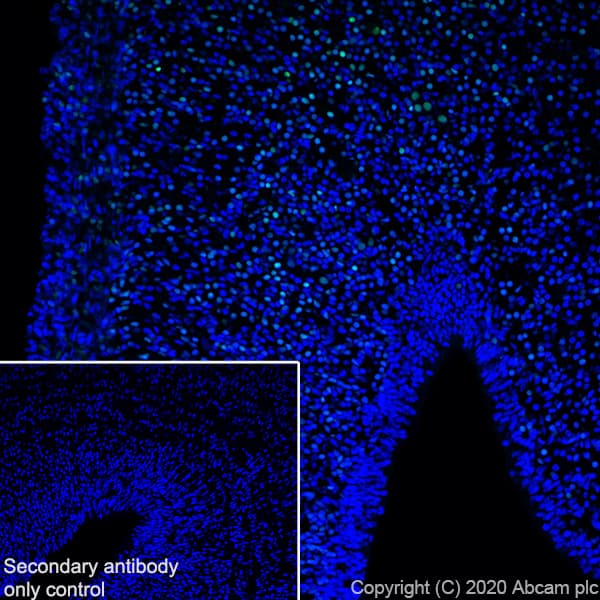 Anti-BRN3A antibody [EPR23257-285](AB245230)
