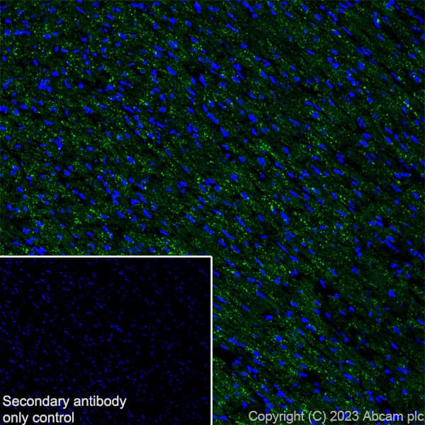 Fyco1 Antibody Epr28361 79 Bsa And Azide Free Ab316013  Immunohistochemistry Frozen Sections Img426154