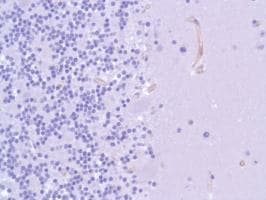 Anti-Nestin antibody [SP103](AB105389)