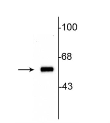 Anti-Tyrosine Hydroxylase antibody - Neuronal Marker(AB112)