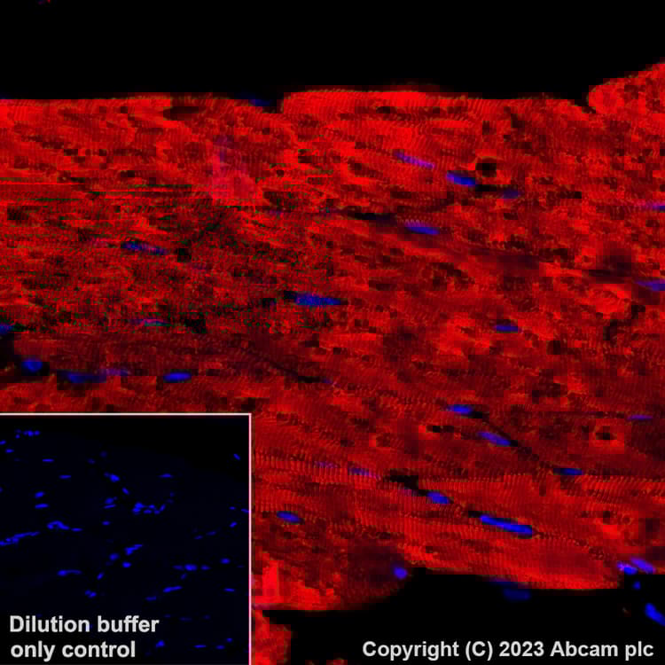 Alexa Fluor® 647 Anti-Myosin (MYH 1/2) antibody [A4.1025](AB315963)