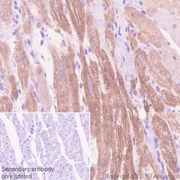 Anti-Slow Skeletal Myosin Heavy chain antibody [EPR22697-17](AB234431)