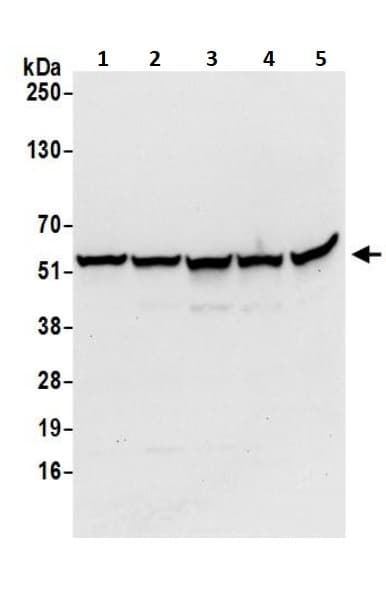 Anti-ATP5A antibody(AB245580)