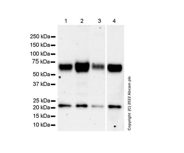Anti-GBA antibody [EPR24106-87] - BSA and Azide free(AB303509)