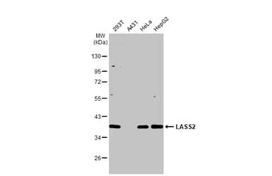 Lass2 Antibody Hl1717 Ab308189  Western Blot Img407276