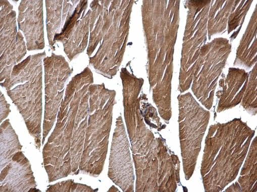 Anti-Hexokinase II antibody(AB227198)