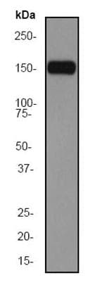Anti-CD11c antibody [EP1347Y] - C-terminal(AB52632)