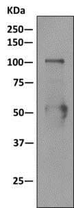 Nucleolin Phospho T76 Antibody Epr8080 2 Ab168363  Immunoprecipitation Img85643