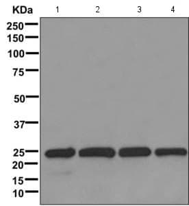 Lsm12 Antibody Epr12282 87 Ab173292  Western Blot Img57314
