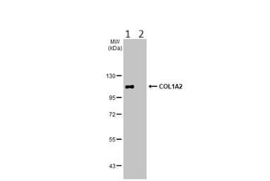 Anti-COL1A2 antibody(AB96723)