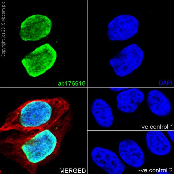 Anti-Histone H3 (tri methyl K9) antibody [EPR16601] - ChIP Grade(AB176916)