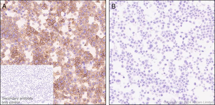 Anti-Lck (phospho Y394) antibody [EPR27974-93](AB318960)
