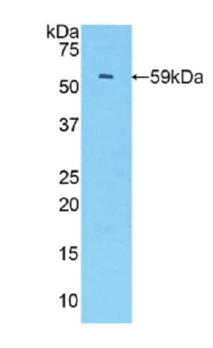 Anti-IRF1 antibody(AB232861)