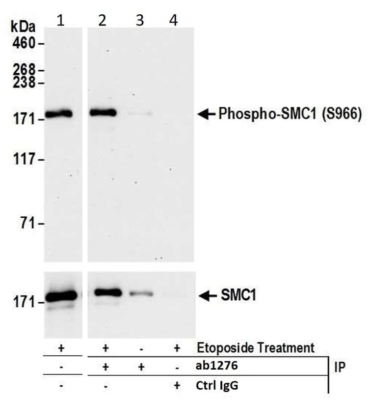 Anti-SMC1A (phospho S966) antibody(AB1276)