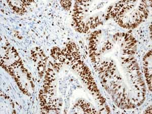 Anti-Ki67 antibody [EPR3610](AB92742)