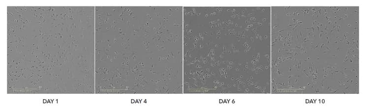 Iomicroglia Human Ipsc Derived Cells Ab317488  Light Microscopy Img429727