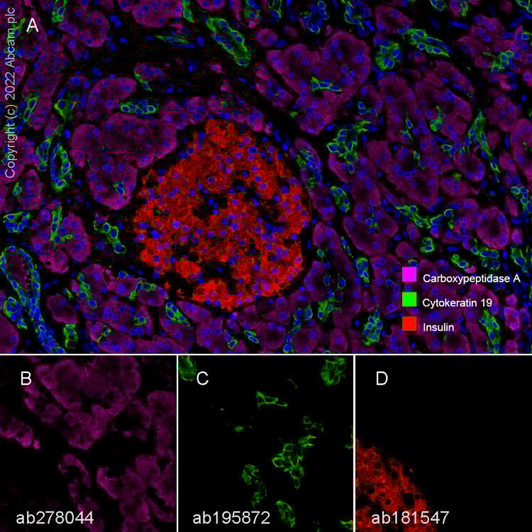 Anti-Insulin antibody [EPR17359](AB181547)