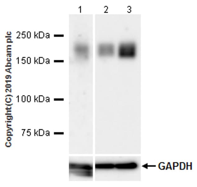 Anti-LRP5 antibody [EPR22477-218](AB223203)
