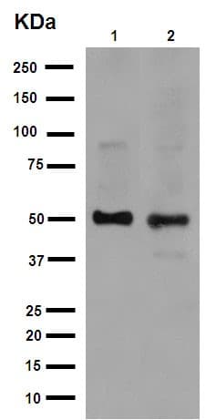 Anti-alpha Sarcoglycan antibody [EPR14773](AB189254)