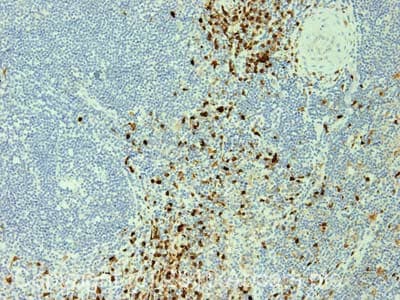 S100a9 Calprotectin S100a8 A9 Complex Antibody Mac387 Ab22506  Immunohistochemistry Formalin Pfa Fixed Paraffin Embedded Sections Img28344