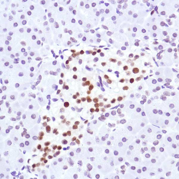 Anti-Cyclin D3/CCND3 antibody [SP207] - BSA and Azide free(AB245734)