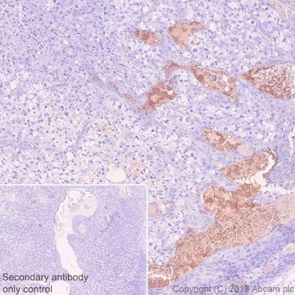 Anti-Fibrinogen alpha chain antibody [EPR2919](AB92572)