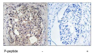 Cdc25a Phospho S178 Antibody Ab79252  Immunohistochemistry Formalin Pfa Fixed Paraffin Embedded Sections Img43585