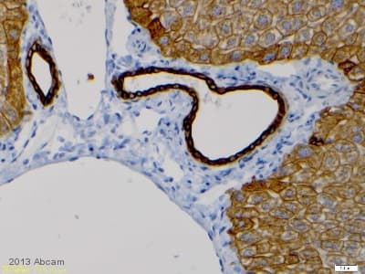 Anti-Cytokeratin 8 antibody [EP1628Y] - Cytoskeleton Marker(AB53280)