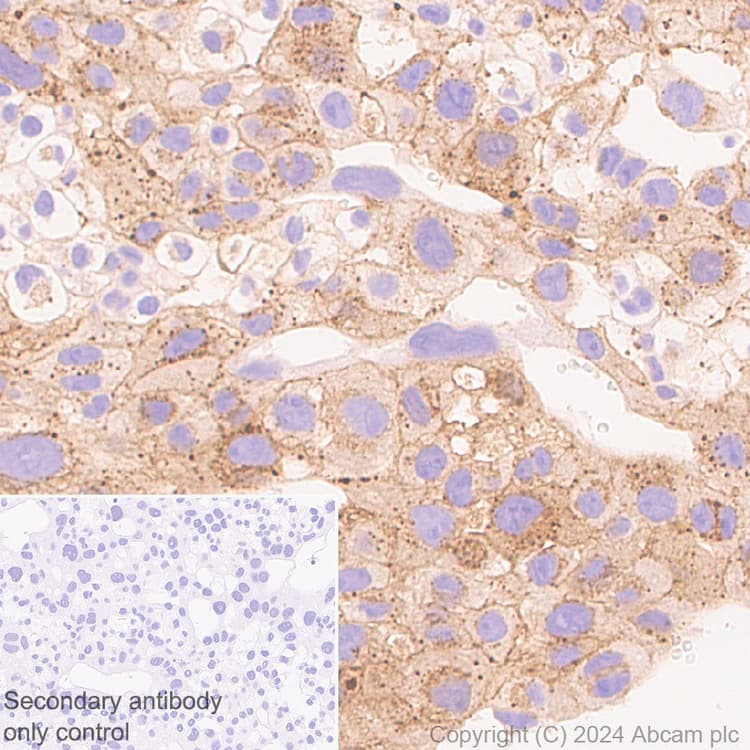 Pai1 Antibody Epr21850 262 Bsa And Azide Free Ab317605  Immunohistochemistry Formalin Pfa Fixed Paraffin Embedded Sections Img431901