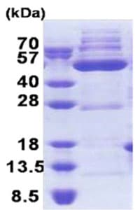 Recombinant Human OXSM protein(AB171708)