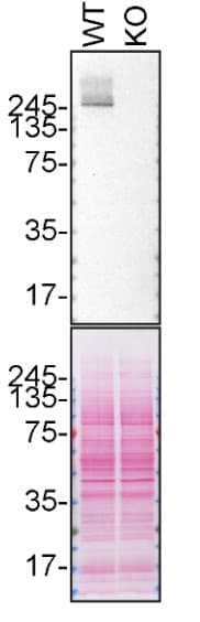 Anti-LRRK2 antibody [MJFF5 (68-7)] - BSA and Azide free(AB237040)