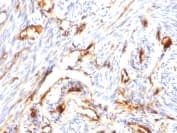 Beta 2 Microglobulin Antibody B2m 1118 Bsa And Azide Free Ab212752  Immunohistochemistry Formalin Pfa Fixed Paraffin Embedded Sections Img31873