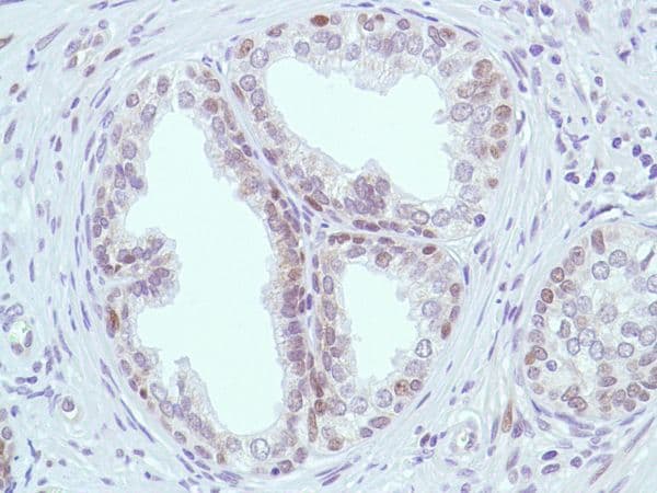Anti-MSH2 antibody [SP46](AB231437)