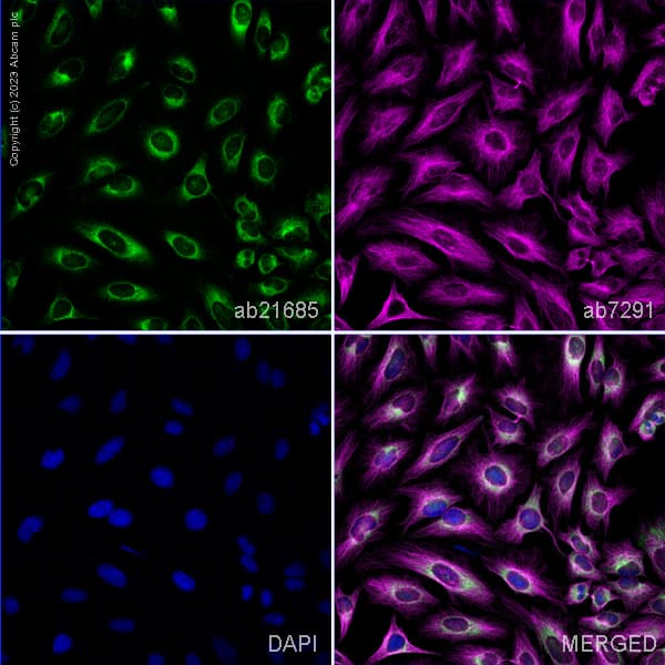 Anti-GRP78 BiP antibody(AB21685)