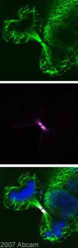 Anti-Aurora B antibody(AB2254)