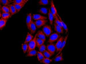 Syvn1 Hrd1 Antibody Ep7459 Bsa And Azide Free Ab249578  Immunocytochemistry Immunofluorescence Img103421
