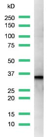 Anti-Cyclin D1 antibody [SP4](AB16663)