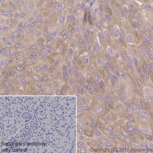 Anti-Retinoic Acid Receptor beta antibody [EPR2017](AB124701)