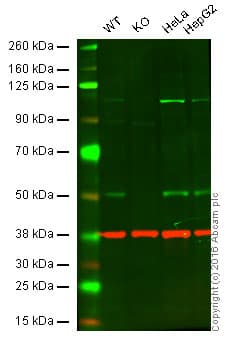 Anti-PHD2 / prolyl hydroxylase antibody [EPR3660(B)(2)](AB133630)