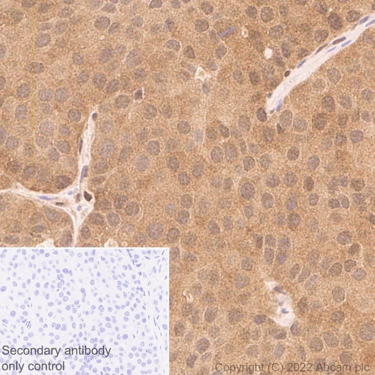Smad2 Smad3 Antibody 18 Smad2 3 Bsa And Azide Free Ab305326  Immunohistochemistry Img406208