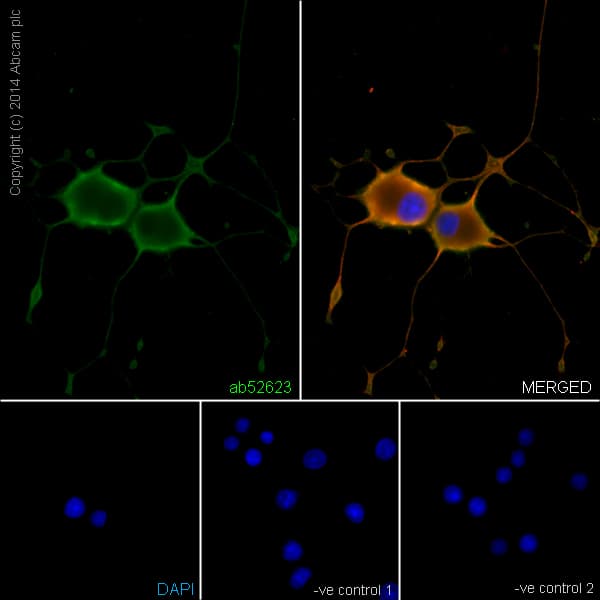 Anti-beta III Tubulin antibody [EP1569Y] - Neuronal Marker(AB52623)
