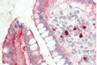 Anti-Myh14 antibody(AB230418)