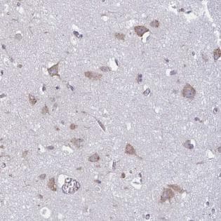 Tmem8c Antibody Ab188300  Immunohistochemistry Formalin Pfa Fixed Paraffin Embedded Sections Img126754