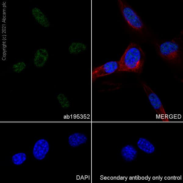 Anti-METTL3 antibody [EPR18810](AB195352)